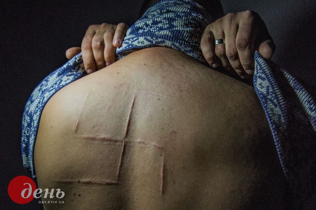 ПРИЗ ПРИЗІВ «ЗОЛОТИЙ ДЕНЬ». Від Ювелірної компанії Dachi Jewellery та Трускавецького готельно-санаторного комплексу «Карпати». Зоя ШУ, м. Київ – за серію робіт «ПІСЛЯ ПОЛОНУ» - (Богдан демонструє шрам у вигляді свастики, що йому вирізали під час 10-годинного полону в Донецьку. Богдану пощастило вижити: за свідченнями людей, які пройшли полон, після завдання каліцтв людину не залишали живою)
